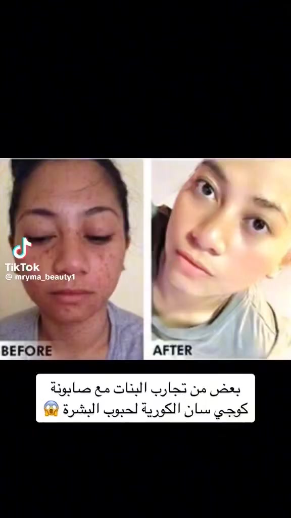 صابون كوجي سان يم زيوت ومنتجات توته


**إذا كنت صاحب هذا الإعلان وتريد حذفه لأي سبب، رجاءا أرسل رسالة إلى الدعم الفني**