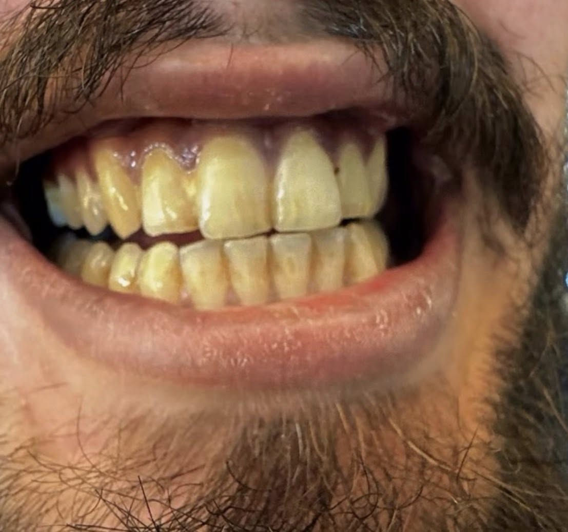 السلام عليكم منشور للفائده ، اني الدكتور محمد صادق طبيب الاسنان توفر يمنا تنظيف الاسنان من التكلسات 
وتصبغات الجكاير 
(العمل مجاني ✅ ) 
العنوان / الحله شارع 40 مجاور صيدليه سلامتك اولا 
للاستفسار 
***********
