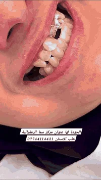 مركز سما • طب الاسنان • الزعفرانية