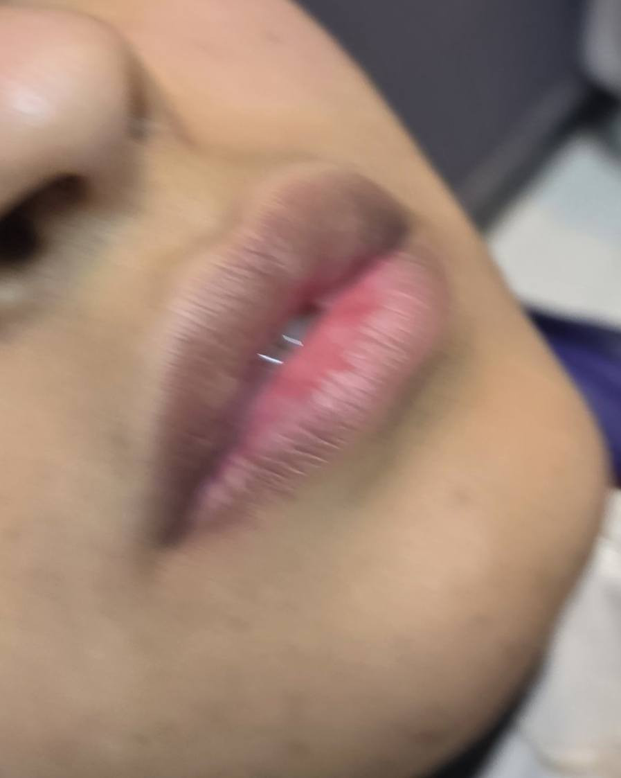 احلى تكنيك طبيعي 
مددت العروض استغلوهه 🎄🎄🎄🎄
فلر الشفه ٥٠ الف cc
كل ثنين اخوات ب٩٠الف cc
التغير الشامل ب٣٠٠الف 
كل ثنين اخوات ب٥٠٠الف

اهلا بكم بعياده تــდــــوته كراند😘😘😘
______________________________
 باشراف الدكتور كريم عبد خلف 
اخصائي الجلديه والتجميل والليزر بورد امريكي وبريطاني بالجراحه التجميليه 
______________________________
العنوان بسمايه قرب اكرم تسوق 
فوق صيدليه احمد طارق 
للحجز والاستفسار 
☎️☎️***********
@إشارة
