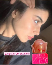 كريم فيفيان • تفتيح البشرة • علاج التصبغات