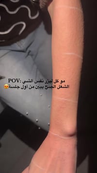 خصم ٢٠٪ • ليزر كانديلا • حي المعلمين