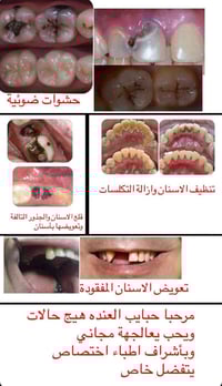 اللي يحتاج قلع بقايا الجذور او تعويض بطقم متحرك يتواصل واتساب 07849832...