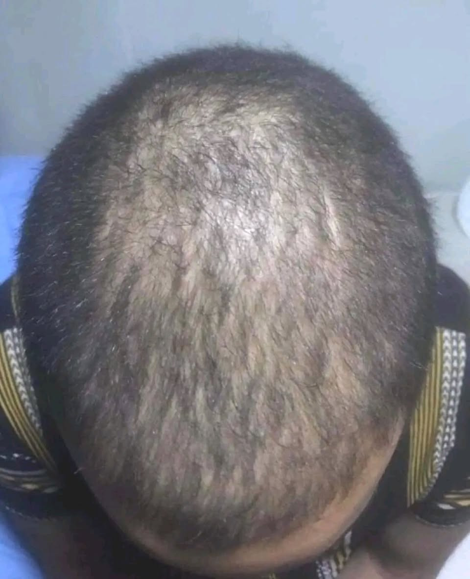 الي يريد العلاج الي عالجت بي شعري يدلل 
علاج كلش زين وفادني للتساقط  الشعر الخفيف


**إذا كنت صاحب هذا الإعلان وتريد حذفه لأي سبب، رجاءا أرسل رسالة إلى الدعم الفني**