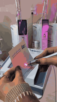 إلى كل الأطباء يقدم لكم الطب الحديث MHD 

♦️جهاز ازالة الاوعية الدموية العنكبوتية
 (Vascular Removal laser) 
‌
‌🔹Laser wave lenght 980nm
  
▪️علاج الشعيرات الدموية بالليزر هو من أحدث الإجراءات المستخدمة في مجال علاج الأوعية الدموية بعيدًا عن العمليات الجراحية عن طريق أشعة الليزر القوية بطول موجي 980nm 

▪️ويعمل الجهاز على إضعاف الشعيرات الدموية فتتصلب وتضمر وتختفي.

▪️وتختلف عدد الجلسات حسب نوع وحجم الاوعية الدموية .

موقعنا بغداد-حي الجامعة-شارع الربيع مقابل بن رضا علوان. 

***********
***********
