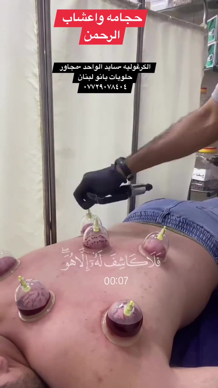 #حجامه واعشاب الرحمن
سايد الواحد - مجاور حلويات بانو لبنان 
***********
