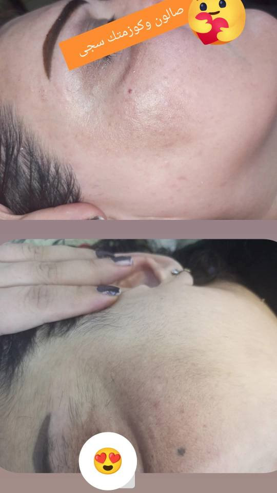 حفافه وتنضيف بشره 5
بدكير للقدام 10
اي ستفسار راسلوني واتساب
*********** عمارة, ميسان
