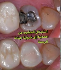 عيادة اسنان الرحمة • سوق المعمل • خصم لأهالي الوحدة