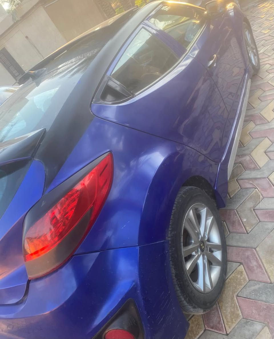 السلام عليكم فولستر 2013 فول موصفات كير مكينه تبريد مكفول بيهه 3قطع صبغ   بدون دواخل  جاملغات ثنين وباب سياره نضيفه رقم بغداد بسمي سعر 74 وبيهه مجال بسيط مكان بغداد للاستفسار ***********
