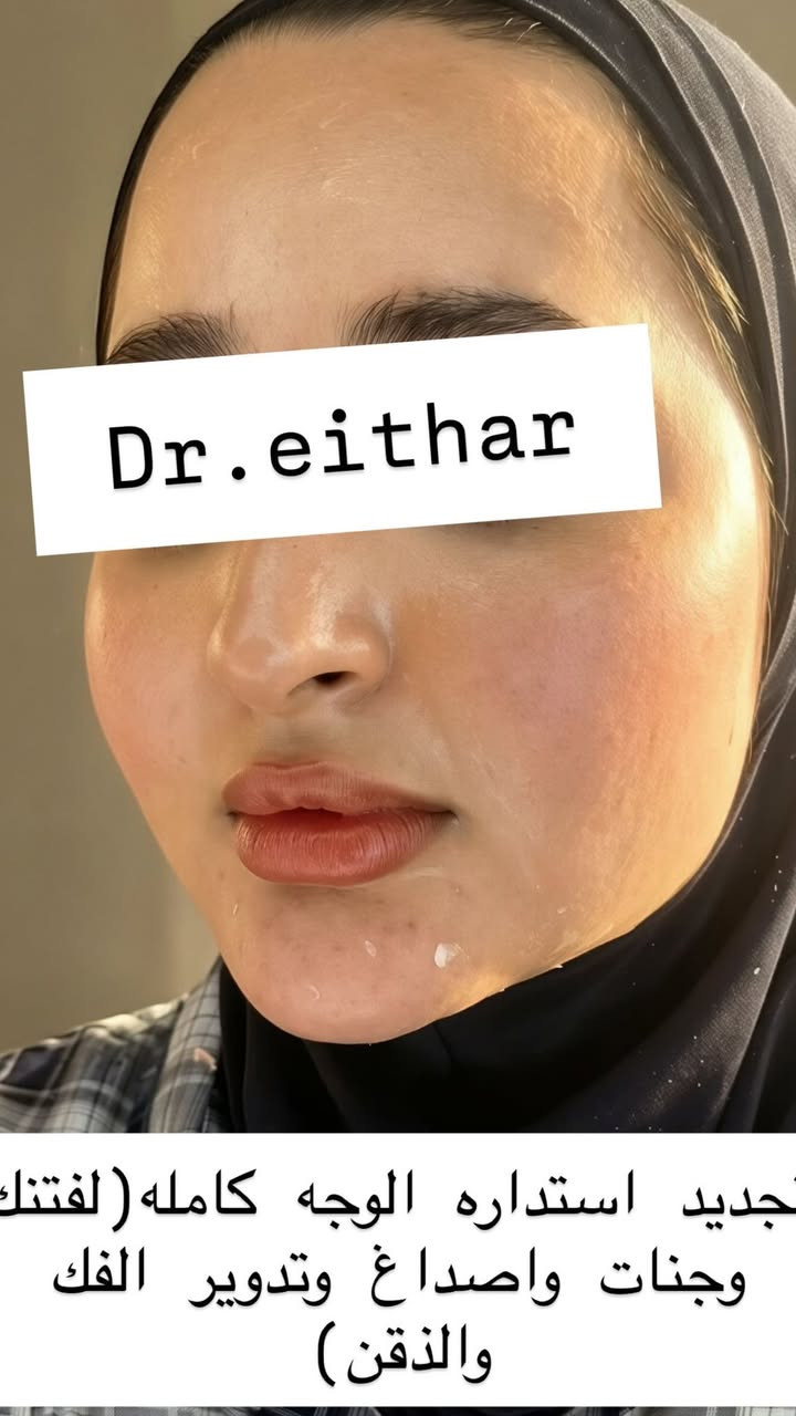 تجديد استداره وجه كامله بطريقة الشد بالفلر (لفتنك وجنات واصداغ  وتدوير الفك والذقن  ونظاره  

اليوم الخميس اخر يوم   للعروض بعد متتكرر نزلتهه الكم بالستوري بالهايلايت 🔥

د.ايثار سامي عبد الامير
الكوت_واسط _الهوره_مجمع القبطان

الحجز***********
