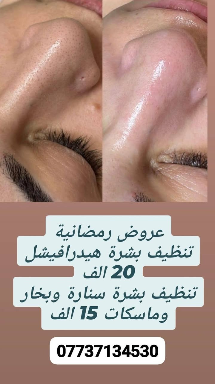 رمضان مبارك حبايبي♠️

♦️مركز عذاري كلينك  للتجميل. @athare195

مسويلكم عروض رمضانيه تخبل 😍♠️

تابعوهم وشوفو عروضهم وشغلهم

📌الموقع.. ميسان سوق مغربه
📞 للحجز والاستفسار تواصل مع رقم المركز ***********

