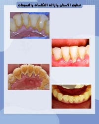 لأن ابتسامتكم تهمّنا 😁👀✨ علاج أسنان (مجـــاني) تحت إشراف دكاترة مختصين...