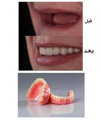 السلام عليكم
اي شخص يعاني من فقدان كامل للاسنان يراسلنا خاص او على الرقم *********** ونثبتلكم حجز 

#العلاج مجاني
