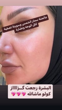 دعم الكولاجين • روتين بشرة • بشرة كزازة