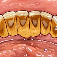 من رخصة ادارة الگروب ، أي احد عندة تكلسات كما في الصورة ⬇️ خل يراسلنا ...