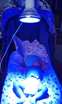 جهاز علاج ابو صفار للأطفال حديثي الولادة واتساب 07764273635