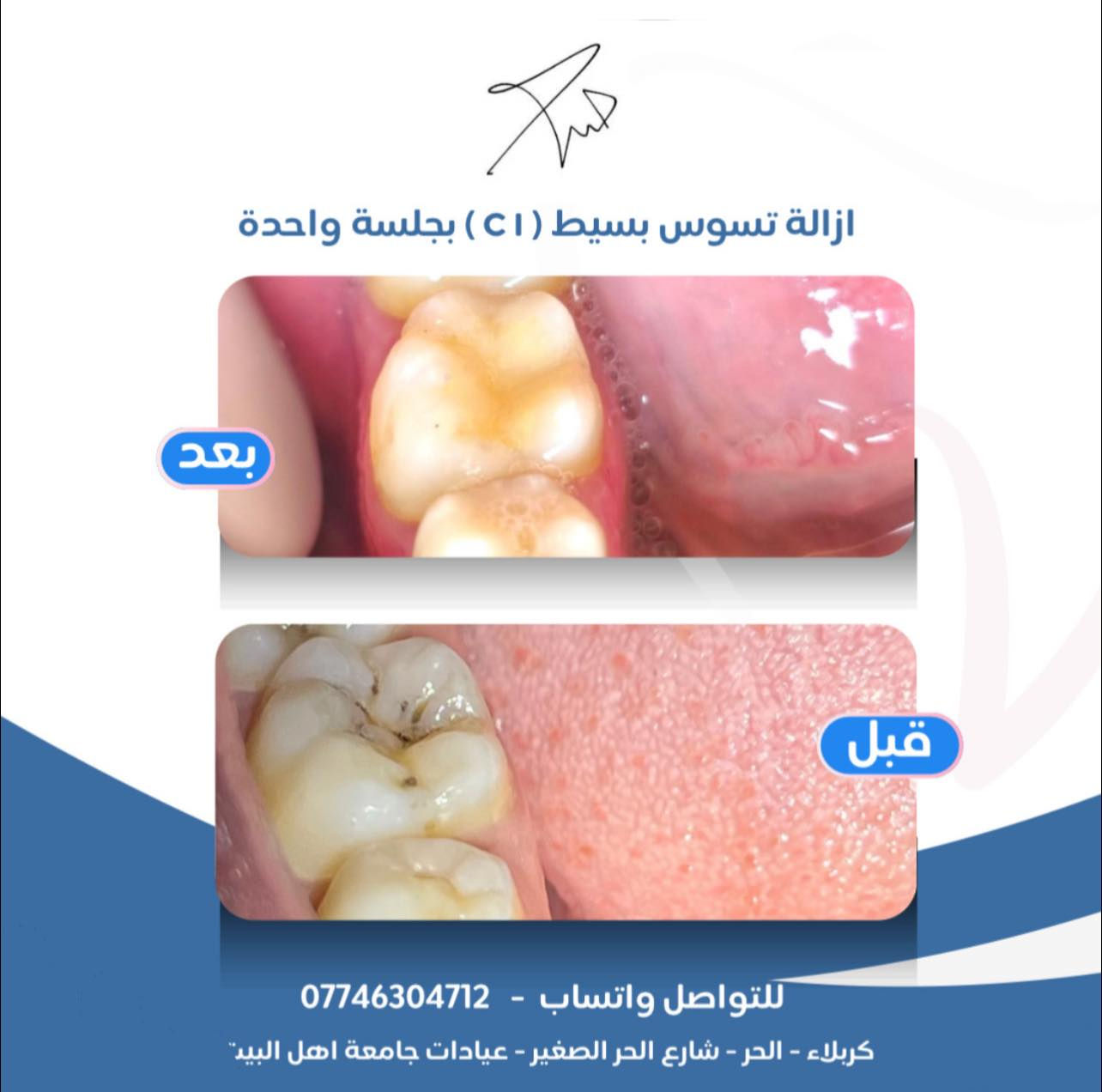 مجانا العلاج
للتفاصيل واتساب
***********
