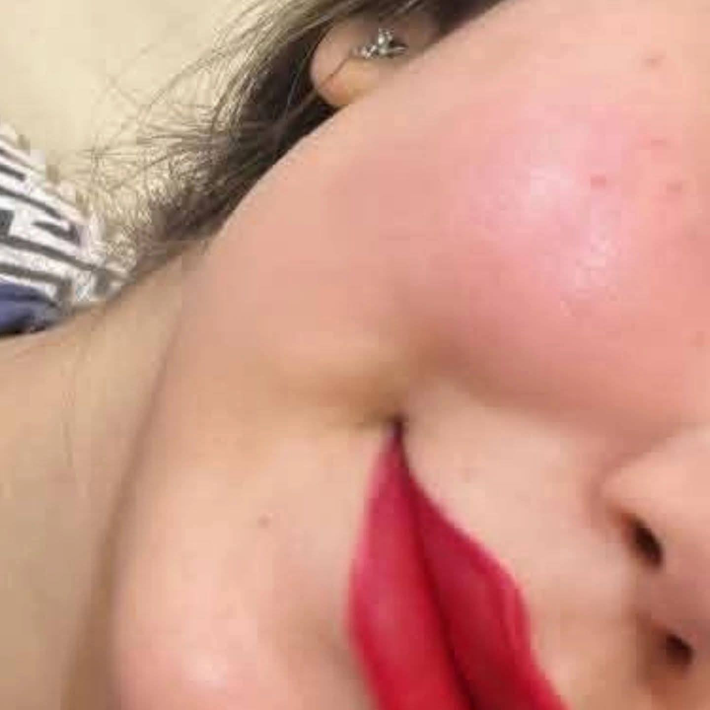 ✨كريم طبيعي✨ بياض ونضاره وتصفيه للوجه خلال اسبوع
خلطه مواد طبيعية شغل ايدي 
خالي من المواد الضاره لاكورتيزون ولاديرمويدين
يعالج الكلف والتصبغات و حب الشباب واثار الحبوب والهالات السوده ويوحد لون البشره


**إذا كنت صاحب هذا الإعلان وتريد حذفه لأي سبب، رجاءا أرسل رسالة إلى الدعم الفني**