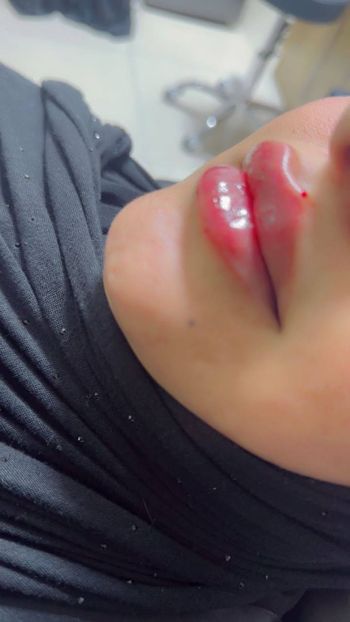 عياده الدكتورة شذى عبد الأمير   مسويتلكم عروض💖 عل فيلر ✨ بمناسبة الفلنتاين ✨
عنوان الحسينية _ عيادات الوادي النوذجية _ مجاور مطعم ابن مدلول الطابق الأرضي 

للحجز والاستفسار ***********
