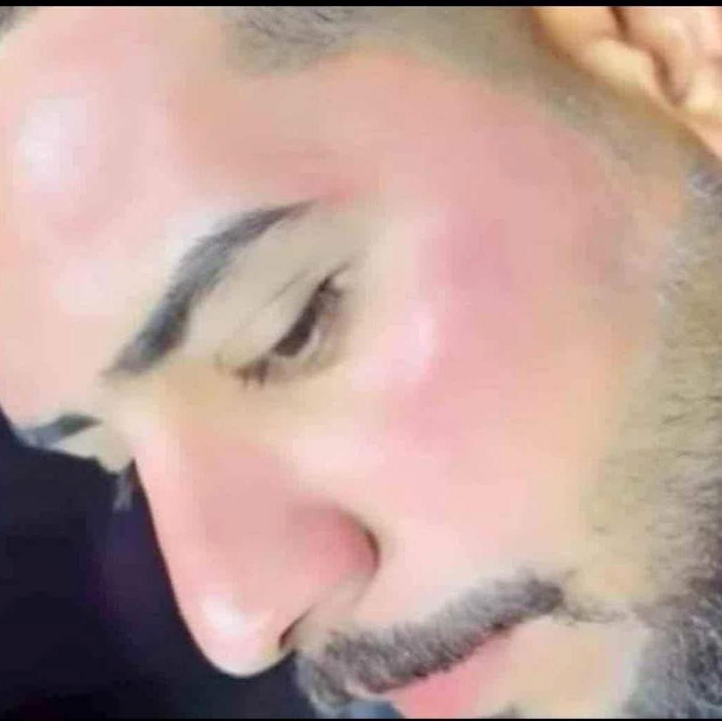 بشرتج تعبانة🥺
خلطه ملامح بريئة للوجه والرقبة  مجربه ومضمونه👇🥰
مجربه من قبل الكثير من زبائننا 🌺 
لاتترك اي اثر سلبي للبشره ولاتعود البشره كما كانت مابيها مواد ضاره مثل درمودين او مواد كيمياويه تضر البشره
*********** 
‏Tabark badea
تجارب الزبائن بالتعليقات مجربة ومضمونة 100%
