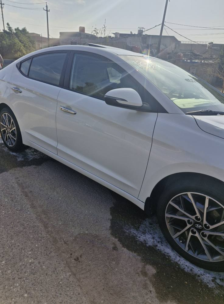 السلام عليكم النترا ٢٠٢٠ خليجي كفاله ضربه وصبغ وتبديل حته المكينه على البلاد برغي ما مفتوح بيهه رقم بصره حره تحويل مكينه ٢٠٠٠ فول واحد عله واحد السعر ١٦٨ وبيهه مجال قليل للاتصال *********** البصرة, العراق
