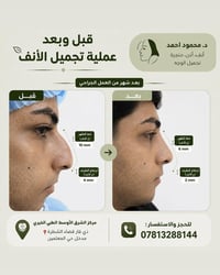 بعد شهر جراحي • الشطرة ذي قار • د. محمود احمد