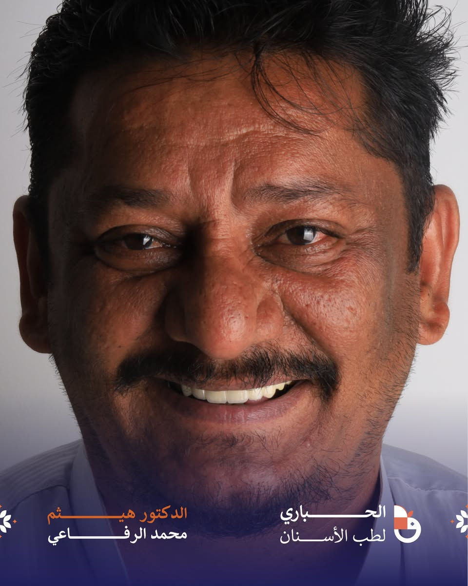 تغيير إبتسامة مراجع و إعادة تأهيل الأسنان بزراعة الأسنان✨. 
المسيب - مجاور مركز صحي المسيب - مقابل مول فاملي المسيب- فوق مطعم سوبر صوص. 

رقم الحجز : ***********
