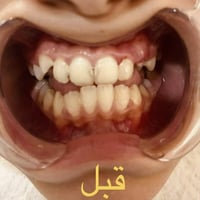 تقويم اسنان • دورة حي دجلة • تقسيط