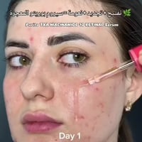 PURITO • نياسيناميد ١٠٪ • ترانيكساميك ٦٪