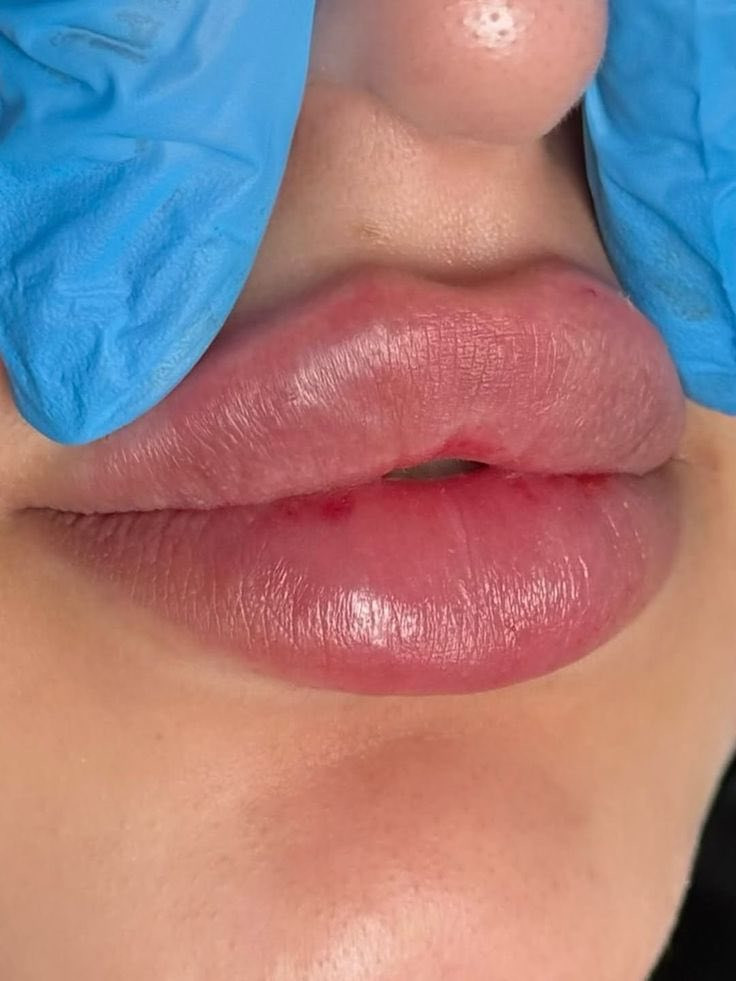 العنوان حي القاهرة مقابل ماركت الباشا
@الرقم ***********

الحجز والاستفسار
