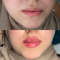 بدون رسم وحدود ==صارت ب رسم وحدود ب 1 سيسي فلر د.علا هادي الشمري   607...