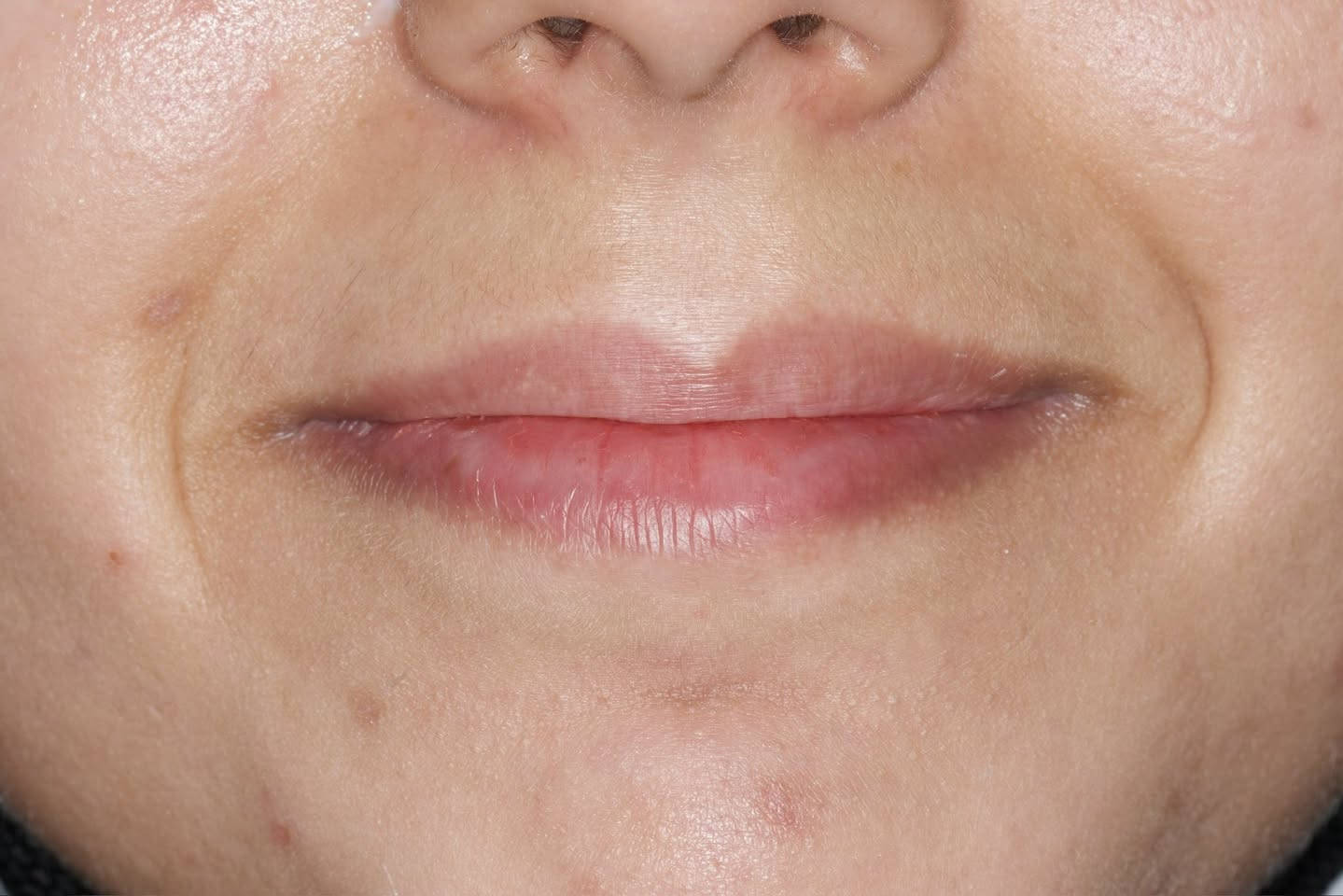 فلر  شفة بالتكنيك الروسي  1cc 💉👄

☎️للحجز والاستفسار مراجعة الصفحة او الاتصال بالرقم
***********

📍العنوان:عيادة الدكتور محمد حسن القريشي/واسط/الحي/شارع حي الوحدة قرب اسواق ريحانة

🛑علما ان المعاينة مجانية لتقويم الاسنان والتجميل اللاجراحي (فلر وبوتوكس)

#explore #واسط  #واسط #  #تجميلاسنان  #ترويج   #تقويمالأسنان
