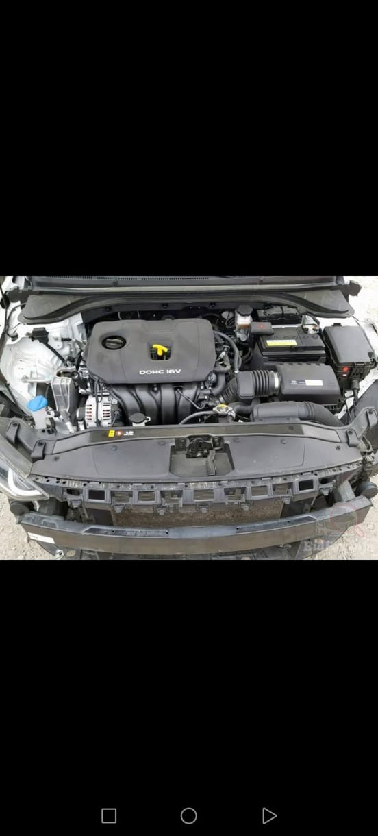 النترا 2017 وارد امريكي. محرك گير شرط. ماشيه 90 تبريدها بشرط ثلج سياره جاهزه مابيها نقص  وضررها موضح بالصوره ( سرقه)  باب +جاملغ.
  *********** 
اسيا ماعندي وذا حبيت تستفسر اكثر  طب خاص وتدلل
