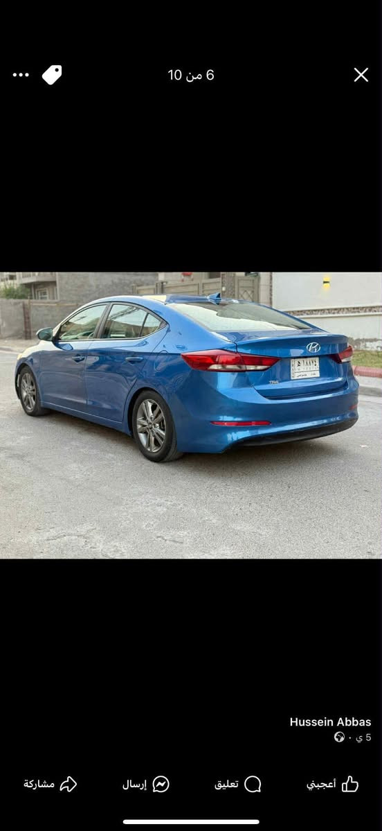 سلام عليكم النترا لبيع مديل 2018
سياره وارد امريكي صور الحادث والسونار. مرفقه بلصور 
محركه 2000 دوش 
سياره. بيه حالوب. 
مكاني الحريه. ***********
السعر. 115.  وبيه مجال
