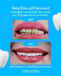 دكتور شادي العجي • ابتسامة بعد العلاج • النصر الصوب الكبير