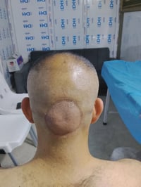 حجامة الشفاء  حجامة كاملة متكونة من خمسة گلاصات  السعر 10 الاف دينار  ...