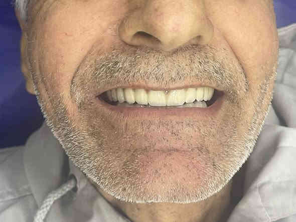 عيادة الدكتورة زهراء الحيدري لطب وتجميل الاسنان

زراعة الاسنان يمنا غير   

انظمة دفع مريحة 💵 

جودة عالية💪 

حلول خاصة لمرضى السكر او ضعف العظام 🦷🪥 

للحجز والاستفسار 

***********

صفحة العيادة 

https://www.instagram.com/dr.zahraalhaidari?igsh=MTNjazNxa3czdnVtbw== Colombo
