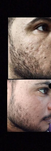 مع منتجات لدورا الأيرانيه لا تحتار توصيل لجميع المحافظات العراق 🇮🇶 078...