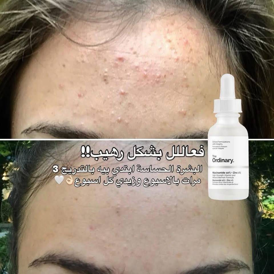 من افضل المنتجات للبشره


**إذا كنت صاحب هذا الإعلان وتريد حذفه لأي سبب، رجاءا أرسل رسالة إلى الدعم الفني**