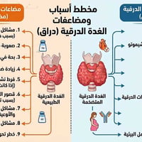 تضخم الغدة الدرقية • المحمودية • مجمع طبي