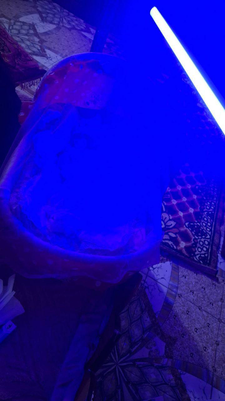 طفلك بيه ابو صفار ونسبتة صاعده ومحتار بدخوليته للمستشفئ  صار يمنه لمبات خاصه ب ابو صفار وانت ببيتك مجرد تخلي الطفل تحت الاضائة الموجية وخلال يومين راح يتعافئ وتنزل النسبة 
كل ماعليك هوا الاتصال بالارقام او مراسلتي خاص  وننطيك كافة المعلومات والتفاصيل
***********
‏‪***********‬‏
