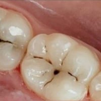 الناصرية • حشوات مجانية • عيادات الجامعة الوطنية