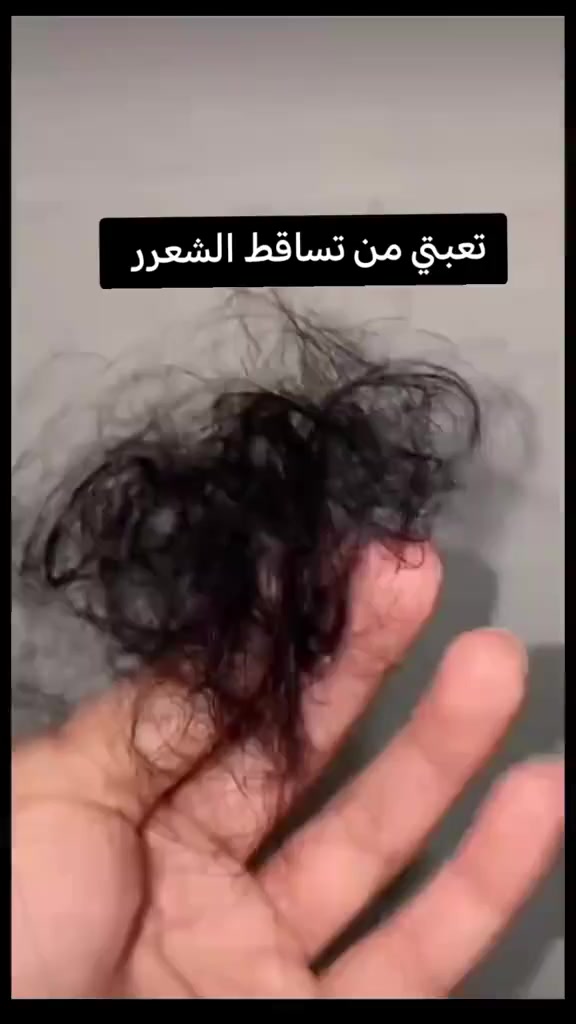 مجموعة prp الشهيرة 🤤❤️
💥يوقف التساقط خلال فترة قصيرة.
⚡️يقوم شامبو بديل الحقن البلازما بتحفيز الخلايا الجذعية في فروة الراس على تجديد الخلايا المسؤولة عن توليد الشعرة من جذوراها
 ⚡️وأيضا تنبت شعر جديد في المناطق التي ليس بها بعوامل هرمونية 
⚡️وايضآ يكثف الشعر ويعمل على ايقان تساقط
#اكسبلور #اكسبلور_explore #اكسسوارات #اكسبلورر #اكسبلور_2020 #اكسبلور_ضيفونا #أكسبلور #فاشن #فاشون #fashion #faahionista #fashionista #fashionable #فستان #عرايس #عروسی #تساريح #تنسيقات


**إذا كنت صاحب هذا الإعلان وتريد حذفه لأي سبب، رجاءا أرسل رسالة إلى الدعم الفني**