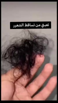 مجموعة PRP • شامبو بديل البلازما • يوقف التساقط