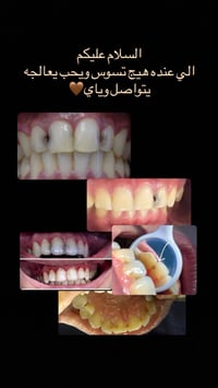 ‭٠٧٨٦ ٧٦٣ ٦٢٦٢‬