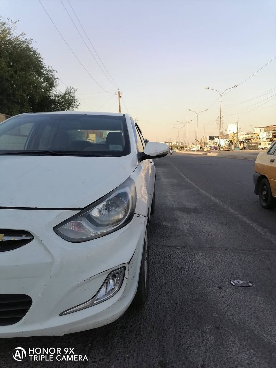 السلام عليكم اكسنت خليجي ٢٠١٤ محرك ١٦٠٠ قطرتين الكشر بي ملاحظات طخات باقي السيارة ميكانيك كهربائيات كلها تمام تبريد ثلج عارضها (75) عنوان بغداد سبع أبكار
***********
السلام عليكم اكسنت خليجي ٢٠١٤ محرك ١٦٠٠ قطرتين الكشر بي ملاحظات طخات باقي السيارة ميكانيك كهربائيات كلها تمام تبريد ثلج عارضها (75) عنوان بغداد سبع أبكار
