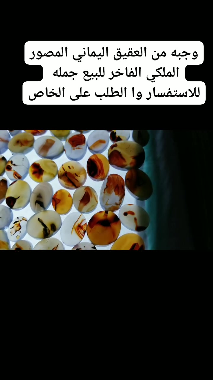 وجبه من العقيق اليماني المصور الملكي الفاخر للبيع جمله 
للاستفسار وا الطلب على الخاص


**إذا كنت صاحب هذا الإعلان وتريد حذفه لأي سبب، رجاءا أرسل رسالة إلى الدعم الفني**