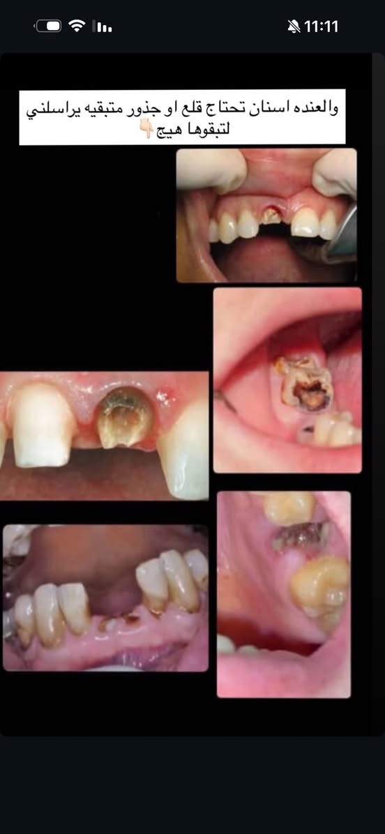 العلاج مجاني وتحت اشراف كادر طبي مختص
***********
