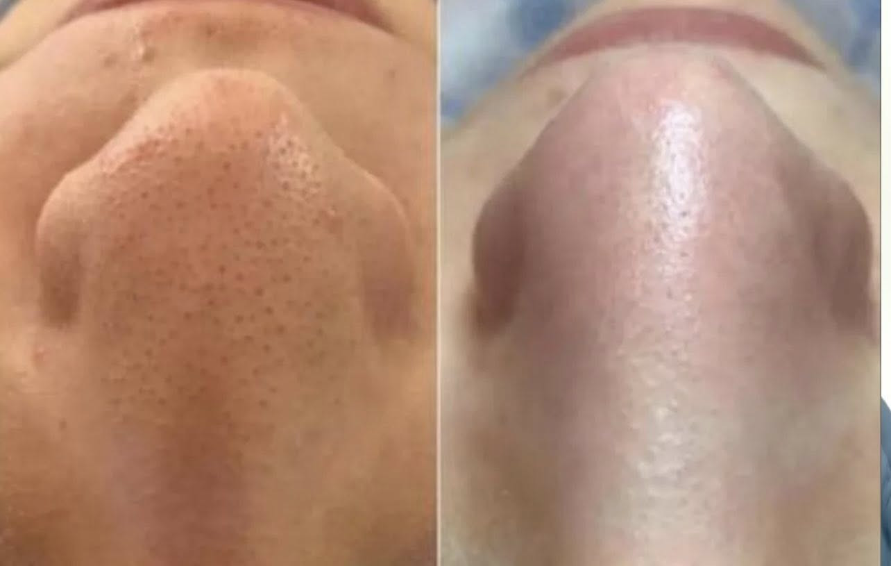 السلام عليكم عروض رمضان تنضيف بشره مواد درجه أولى بسعر 5 الف هديه حفافه وصبغ حاجب مكاني الشعله شارع 60


**إذا كنت صاحب هذا الإعلان وتريد حذفه لأي سبب، رجاءا أرسل رسالة إلى الدعم الفني**