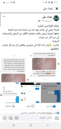 كولاجين • تبييض • نضارة